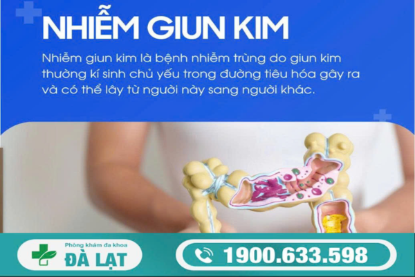 Hình ảnh minh họa